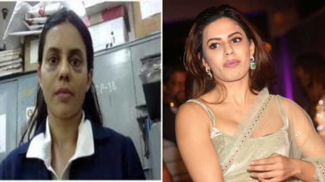 Ranya rao black eye 2