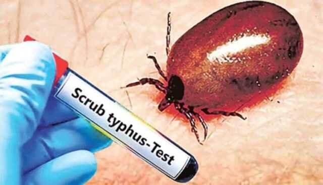 Scrub typhus 750x430