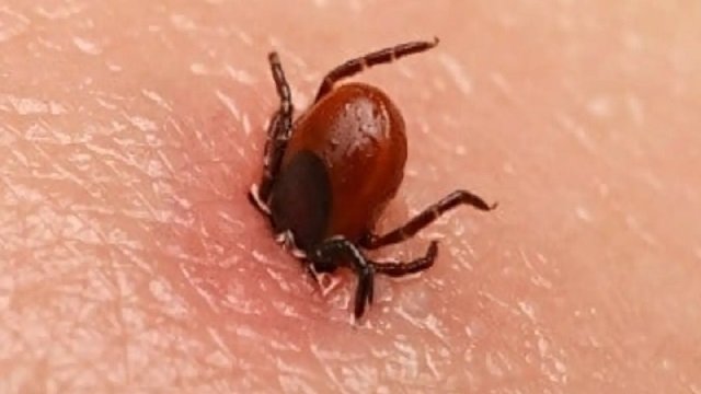 Scrub typhus